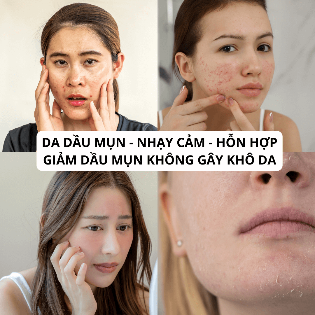 Gel rửa mặt ngừa mụn Canova Salipil Detergente Sifarma giúp loại bỏ bụi bẩn, tế bào chết, làm giảm và ngăn ngừa mụn (150ml)