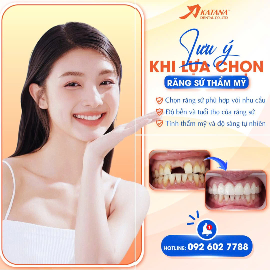 Lựa chọn răng sứ thẩm mỹ: Những lưu ý quan trọng để có nụ cười bền đẹp