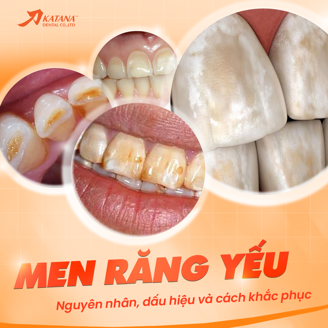 Men răng yếu là gì? Dấu hiệu, nguyên nhân và cách khắc phục