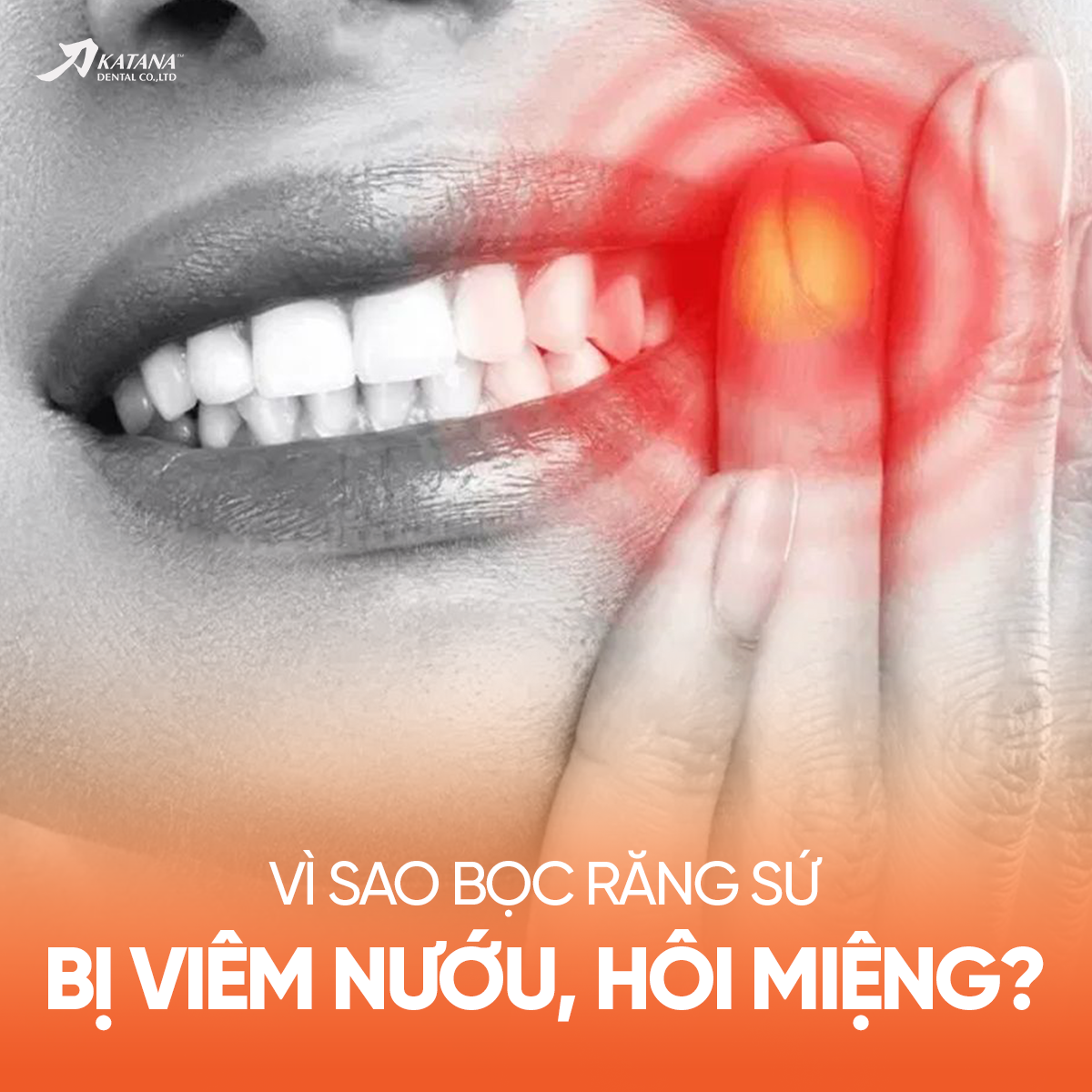 VÌ SAO BỌC RĂNG SỨ XONG LẠI BỊ VIÊM NƯỚU, HÔI MIỆNG?