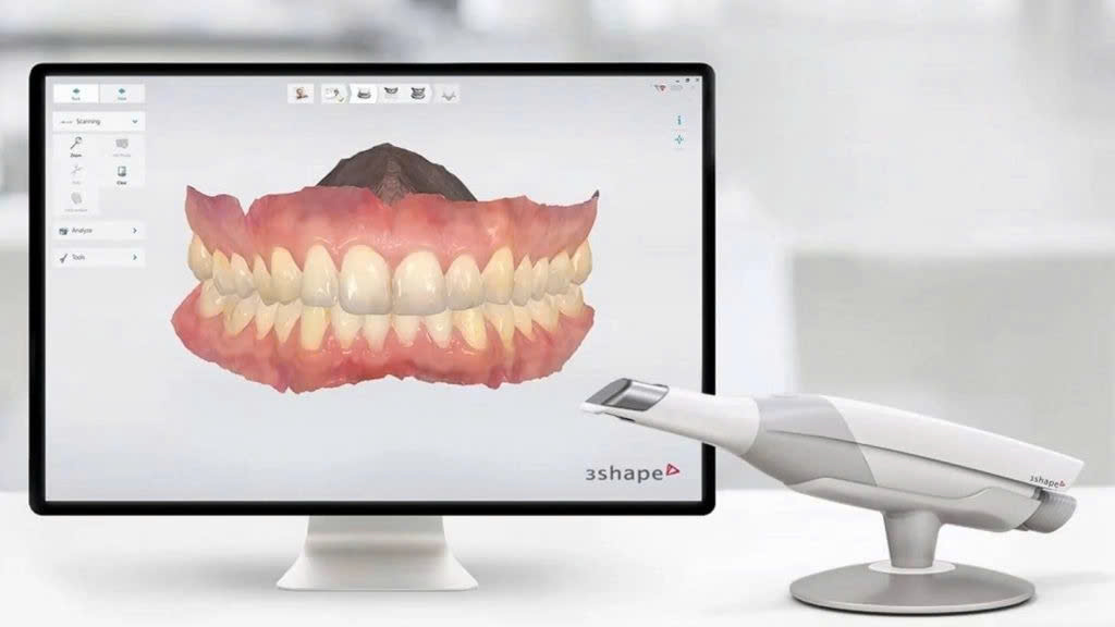 Bọc răng sứ có bền không 2