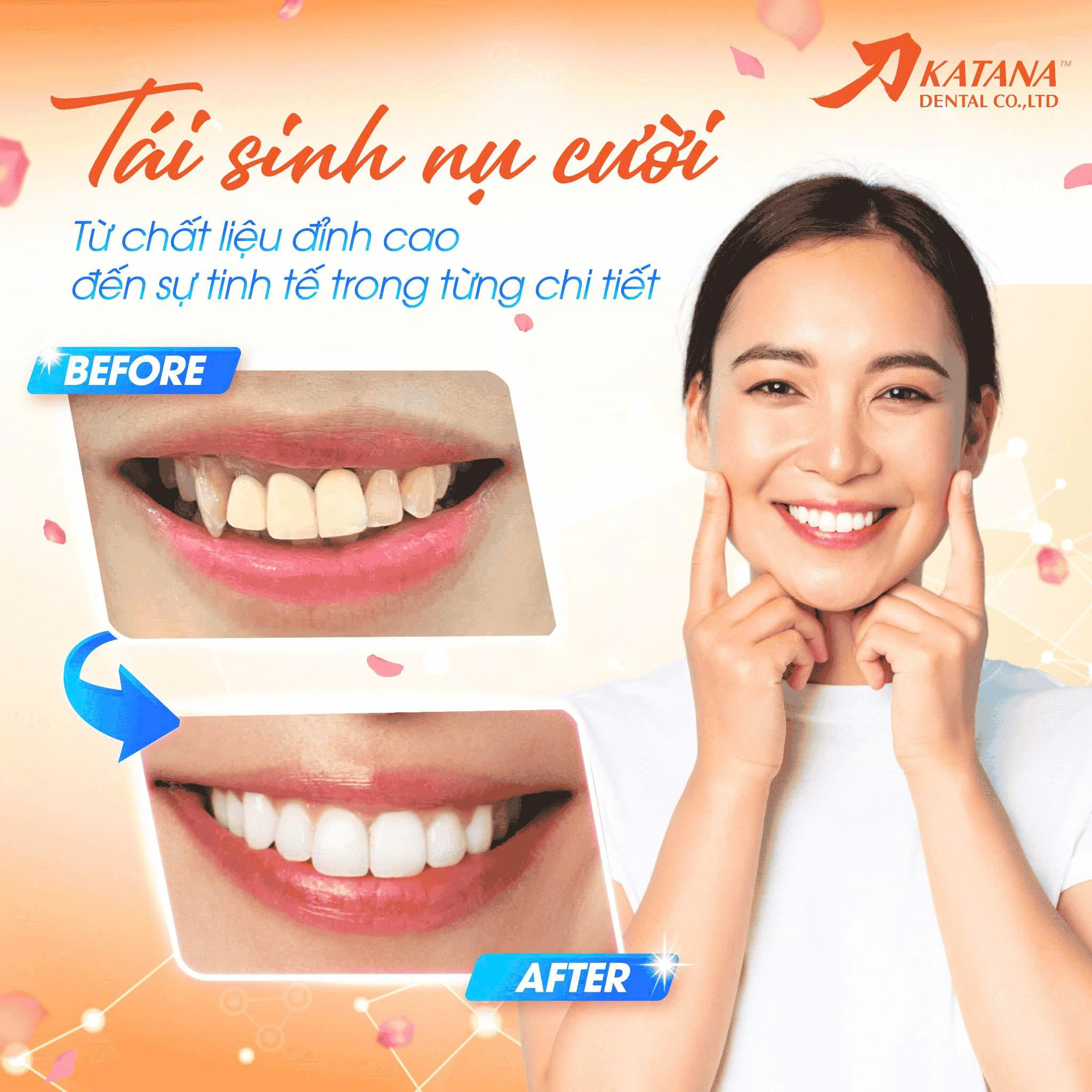 Có nên làm răng sứ 1