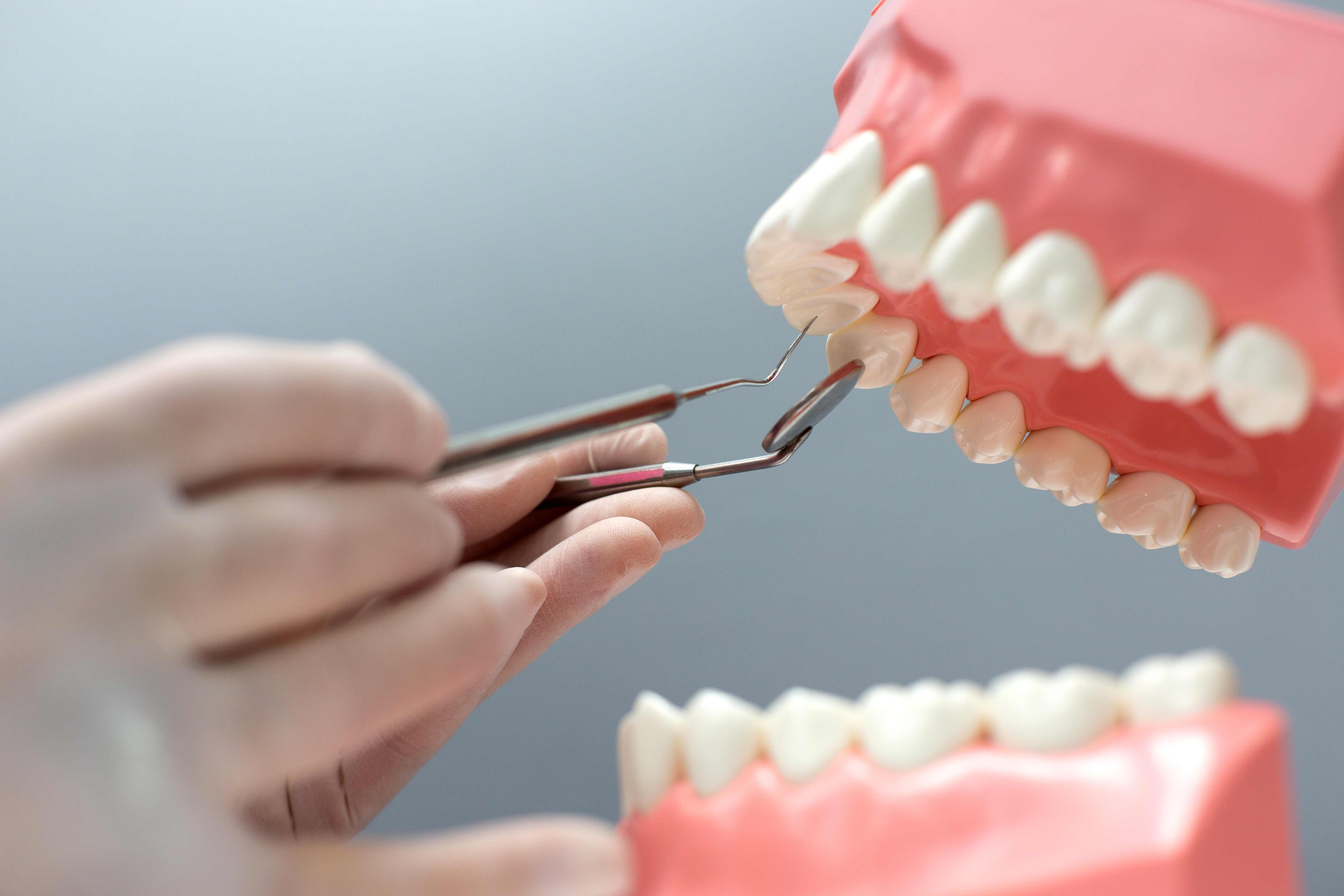 Có mấy loại răng sứ 1