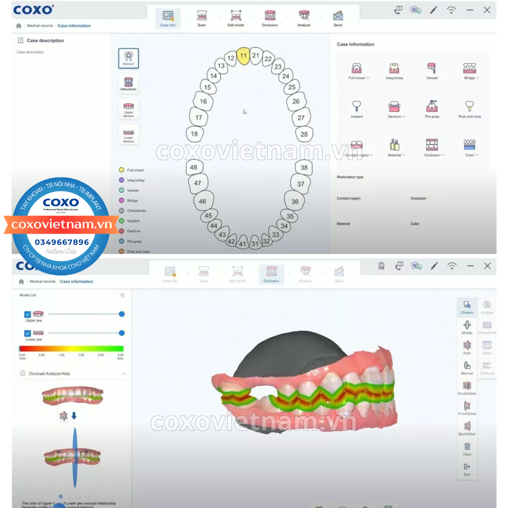 Máy quét scan trong miệng COXO DL-300P