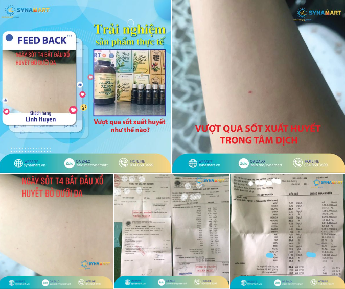 MÌNH ĐÃ VƯỢT QUA SỐT XUẤT HUYẾT TRONG TÂM DỊCH NHƯ THẾ NÀO?