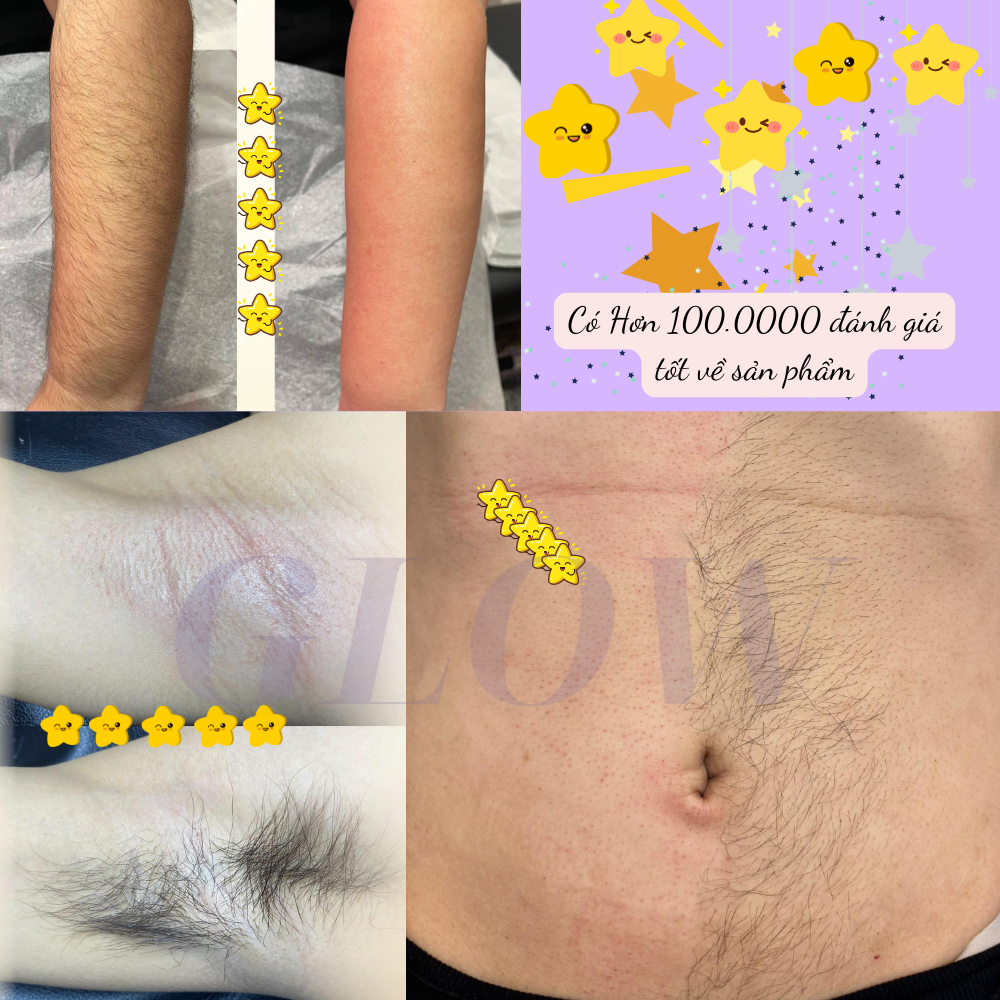 Combo Nồi Đun Sáp Wax Lông ProWax 100 + 100gram Sáp Dừa Hồng Wax Lông Cao Cấp,Siêu Bám Lông, Dành Cho Mọi Loại Da GLOW WAXING Tặng Que CHE TÊN - 8582