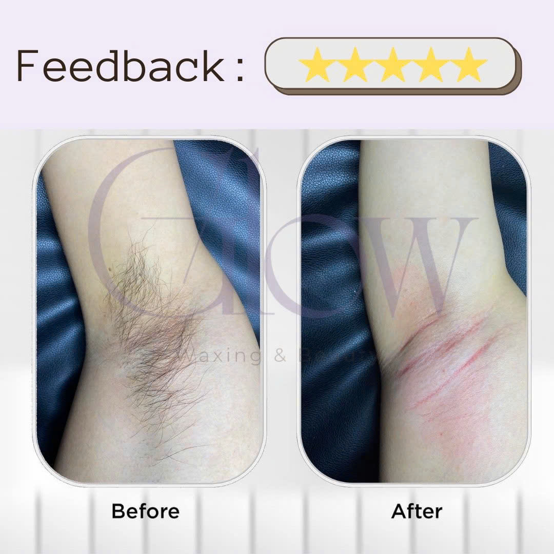 Combo 100Gr Sáp Wax Lông Ngọc Trai + Mỡ Trăn Nguyên Chất 100% Siêu Bám Lông Dùng Cho Da Nhạy Cảm GLOW WAXING CHE TÊN