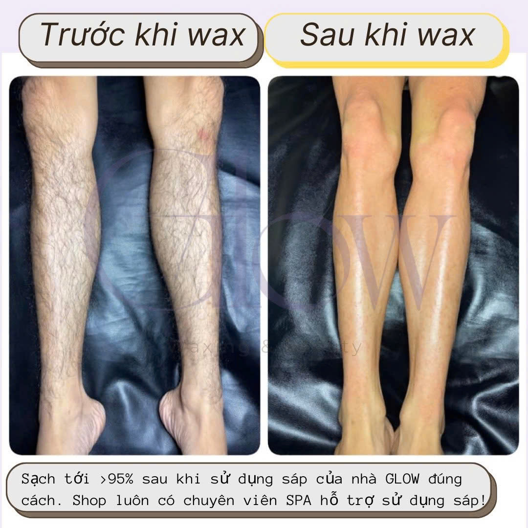 Combo 100Gr Sáp Wax Lông Ngọc Trai + Mỡ Trăn Nguyên Chất 100% Siêu Bám Lông Dùng Cho Da Nhạy Cảm GLOW WAXING CHE TÊN