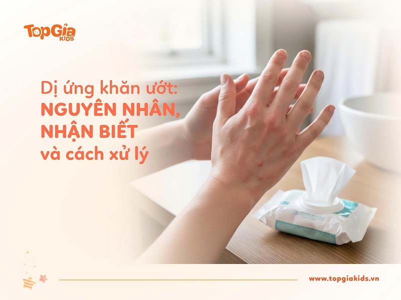 Dị ứng khăn ướt? Nguyên nhân, cách nhận biết và xử lý hiệu quả