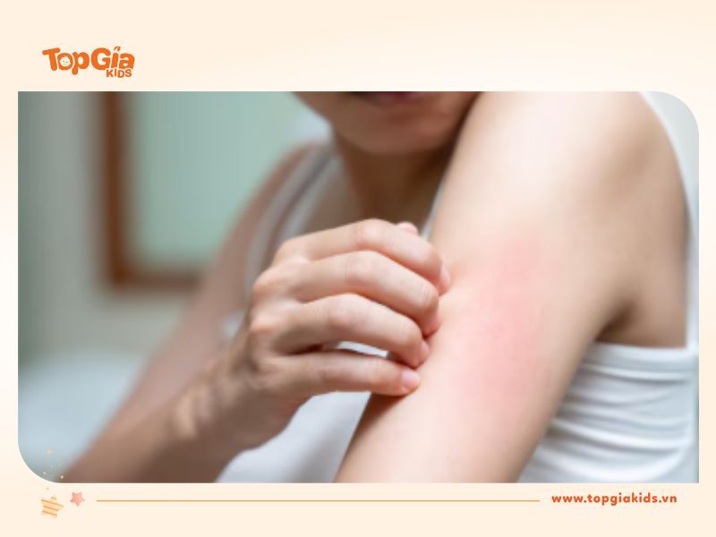 Cách nhận biết da bị dị ứng sau khi dùng khăn ướt