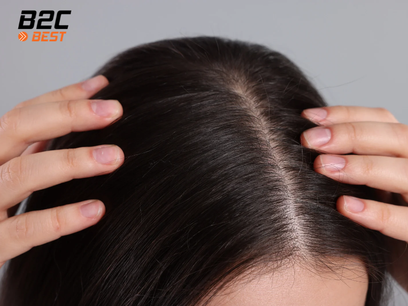 Chăm Sóc Da Đầu Có Quan Trọng Hơn Chăm Sóc Tóc?