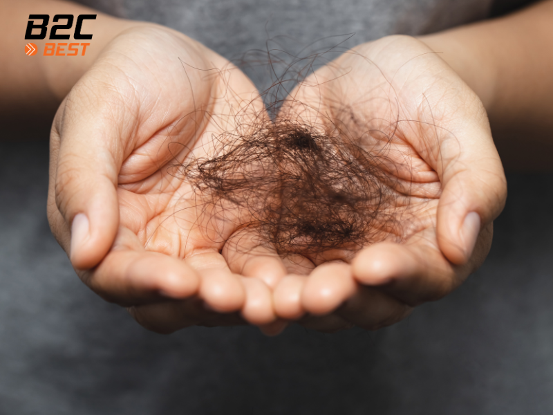 Tóc Rụng Nhiều Là Do Hư Tổn Hay Đang Trong Giai Đoạn Rụng?