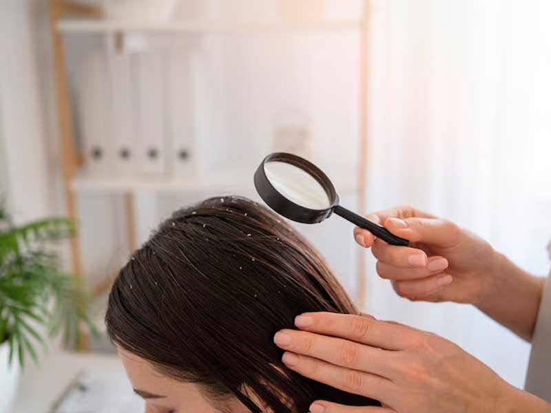 Hướng Dẫn Tẩy Tế Bào Chết Da Đầu Tại Nhà Đúng Cách