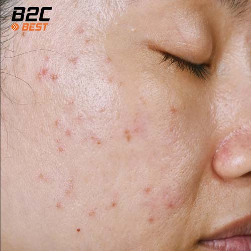 Vì Sao Không Cần Rửa Mặt Vào Buổi Sáng-7