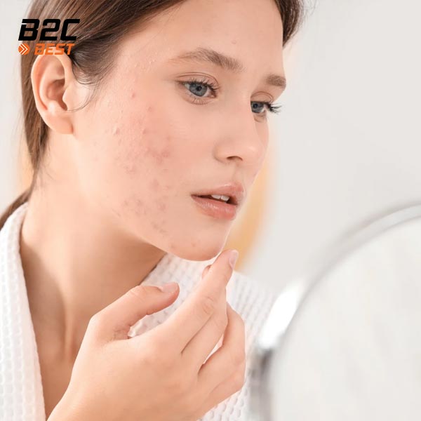 Bao Lâu Nên Thay Đổi Sản Phẩm Chăm Sóc Da-4