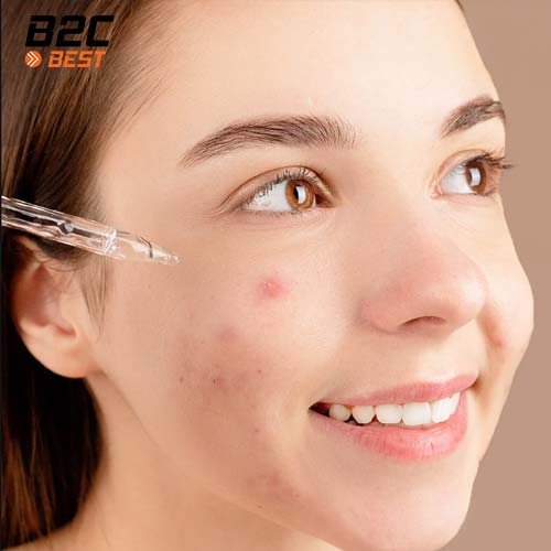 cách tẩy da chết cho da mụn đúng chuẩn-3