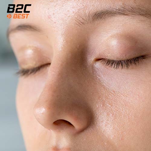 da dầu có nên dưỡng ẩm