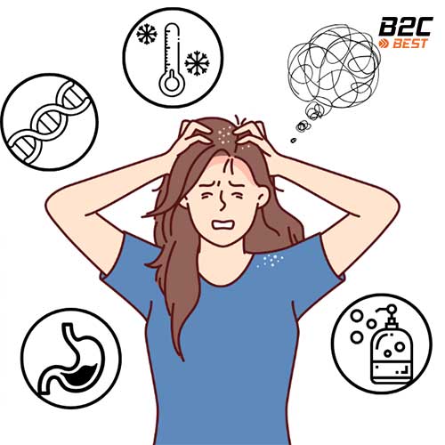 nguyên nhân gây ra gàu thường gặp