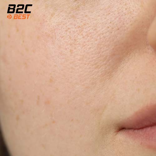 ngồi máy lạnh nhiều bị khô da và cách chăm sóc da-1