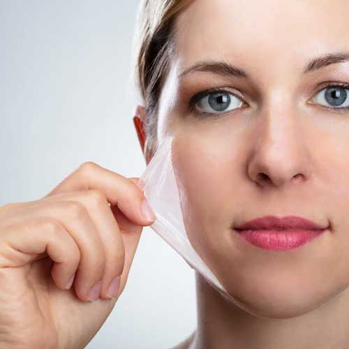 tẩy tế bào chết hóa học