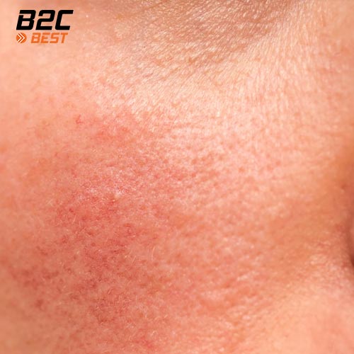 rữa mặt cho da nhạy cảm