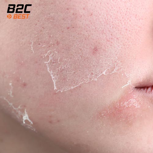 tác hại của rửa mặt quá ít hoặc quá nhiều