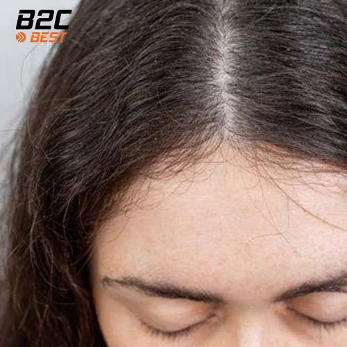 tóc rễ tre là gì