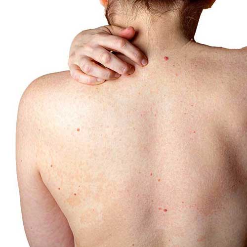 sua-tam-cho-da-nhay-cam