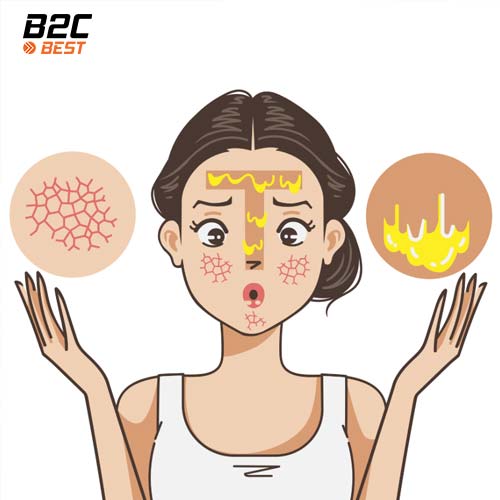 phân biệt làn da của bạn