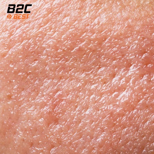 vì sao da dầu có thể bị khô