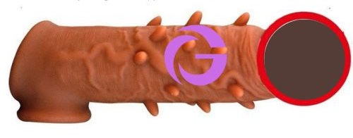 Bao đôn dên Top Notch gai và gân