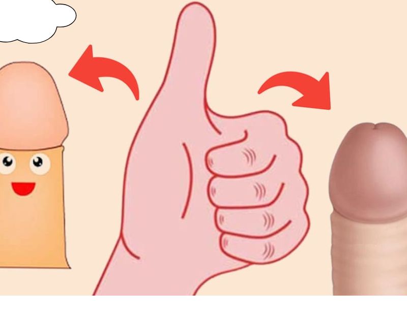 Bao quy đầu bình thường là như thế nào? Dấu hiệu & cách chăm sóc