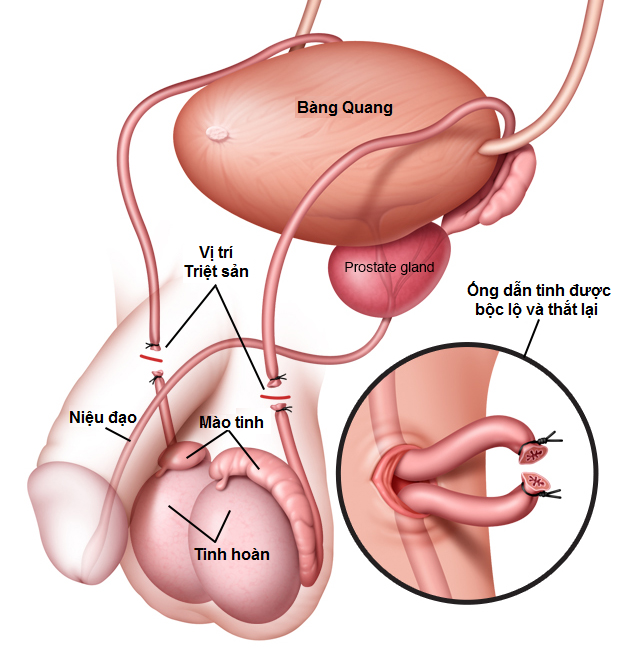 Quá Trình Xuất Tinh Ở Nam Giới: Hiểu Đúng Để Bảo Vệ Sức Khỏe Sinh Sản