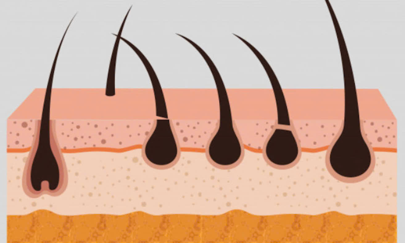 Có nên “dọn cỏ” cho bé ciu ?