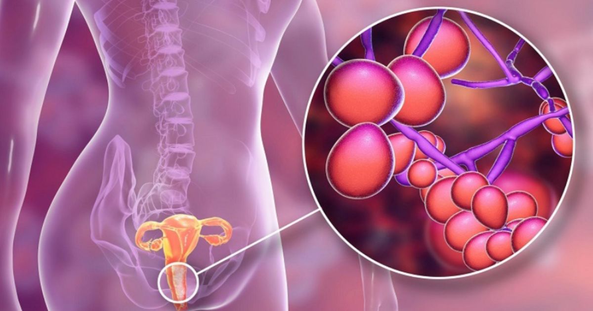 Cách phòng ngừa tiểu buốt sau quan hệ bạn cần biết