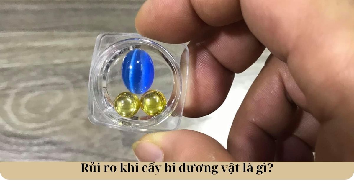 Rủi ro khi cấy bi dương vật là gì?