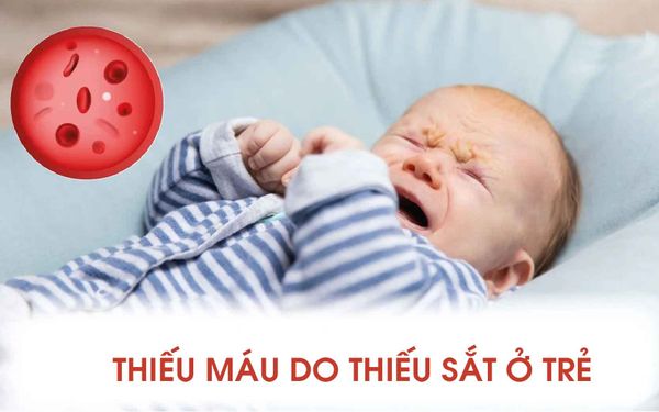 Thiếu sắt ở trẻ sơ sinh: Dấu hiệu và ảnh hưởng cần biết