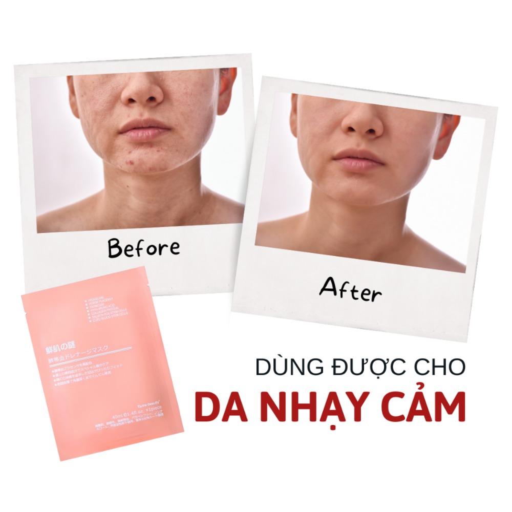 Mặt nạ nhau thai cừu cuống rốn tế bào gốc Nhật Bản Rwine Beauty dưỡng da, cung cấp độ ẩm, tái tạo collagen