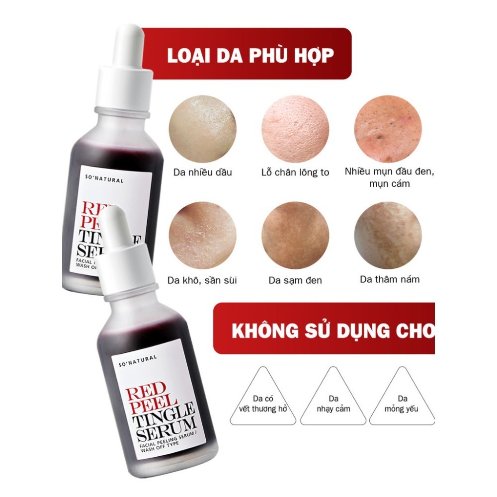 Serum Tinh Chất Red Peel So Natural - Peel Da Lành Tính, Đào Thải Tế Bào Chết & Làm Sáng 11ML-35ML