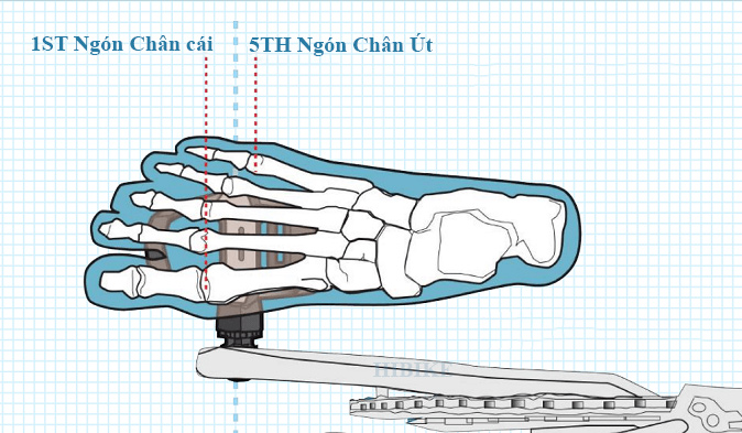 Dụng Cụ Điều Chỉnh Can Giày Xe Đạp LEBYCLE