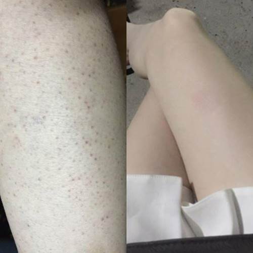 KEM BODY 2% BHA PAULACHOICE SKIN REVEALING BODY LOTION