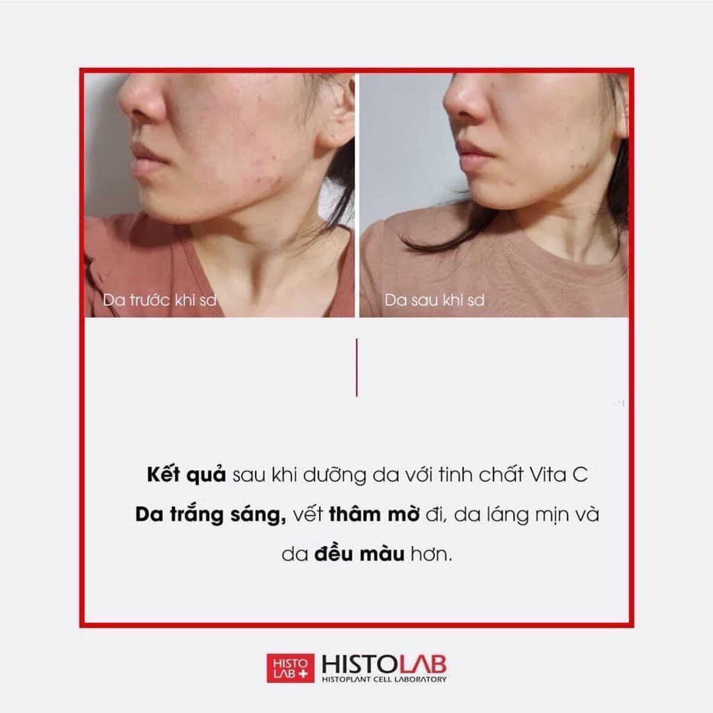 SERUM HISTOLAB 47% VITA C