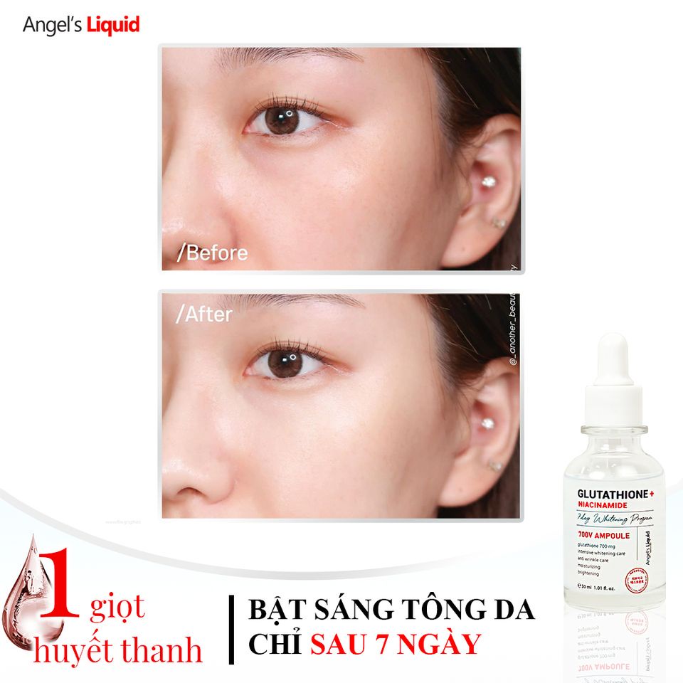 HUYẾT THANH ANGEL'SL NIACINAMIDE