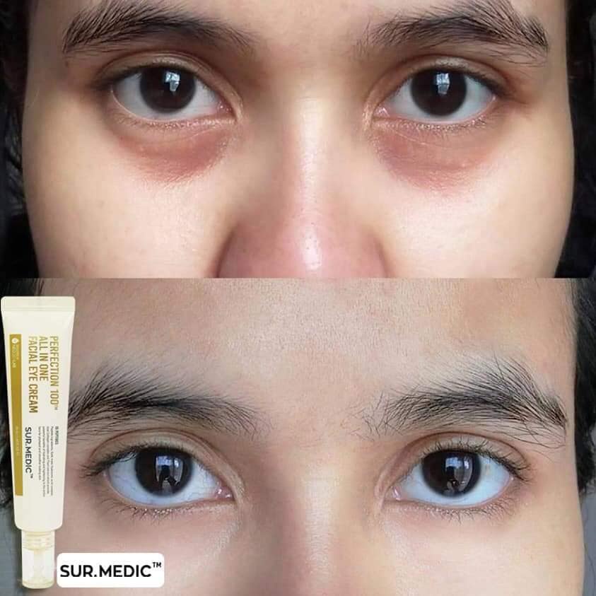 KEM MẮT SUR.MEDIC+