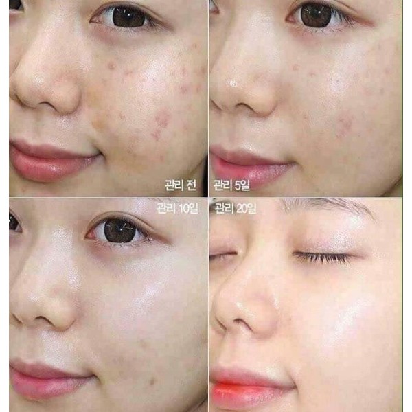 SERUM SKIN1004 MADAGASCAR CENTELLA AMPOULE