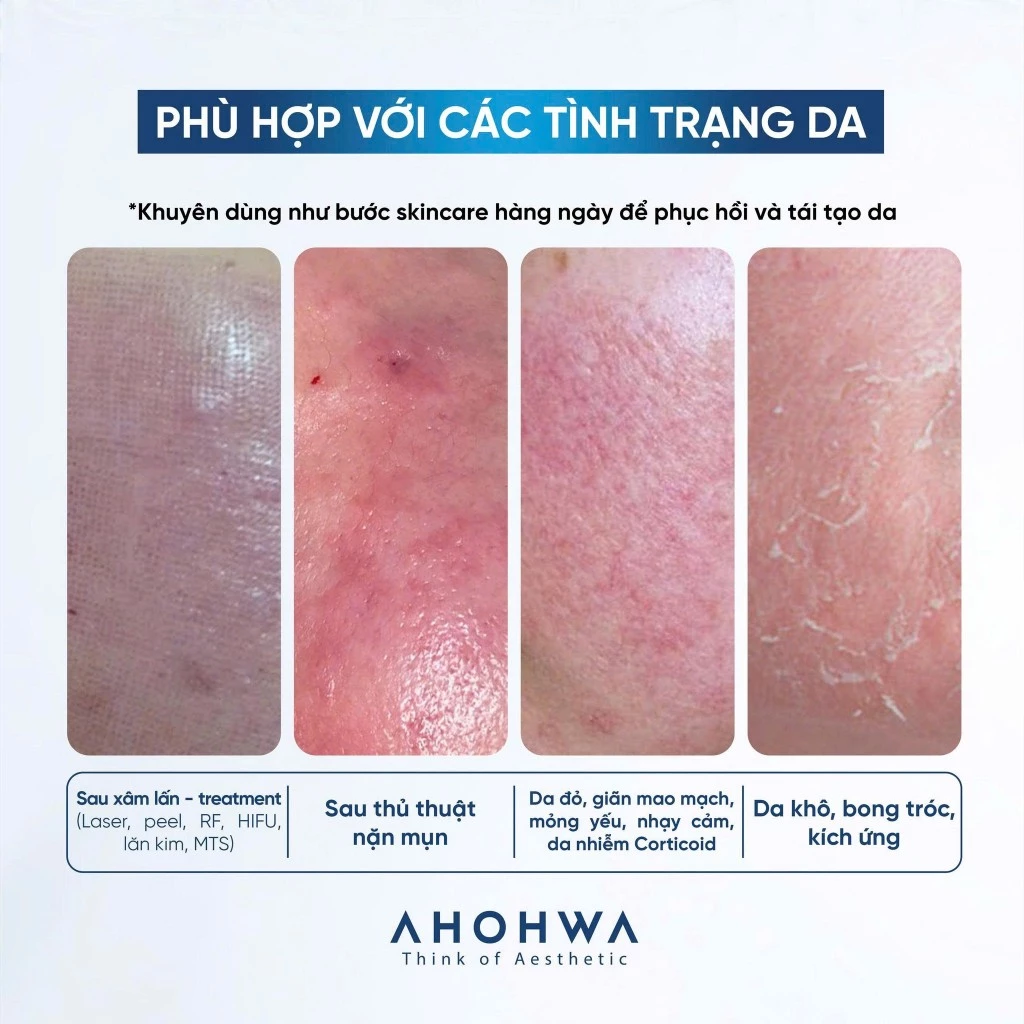 Mặt Nạ Phục Hồi Giảm Đỏ Ahohwa Vitamin K Calming Mask