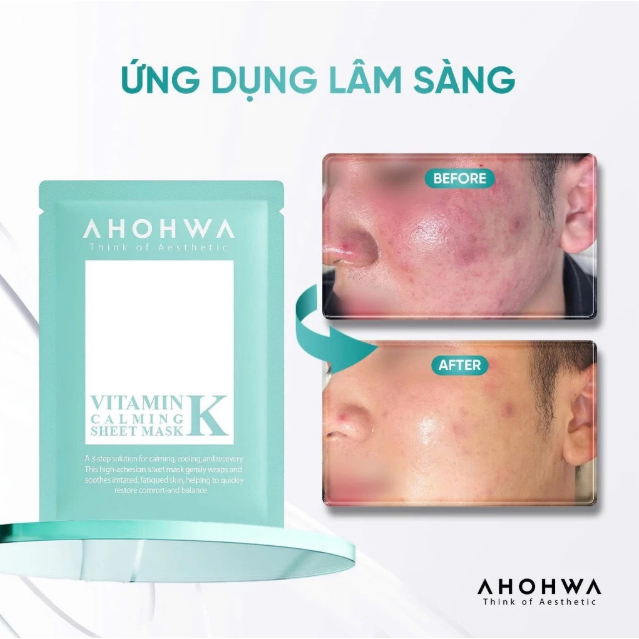 Mặt Nạ Phục Hồi Giảm Đỏ Ahohwa Vitamin K Calming Mask
