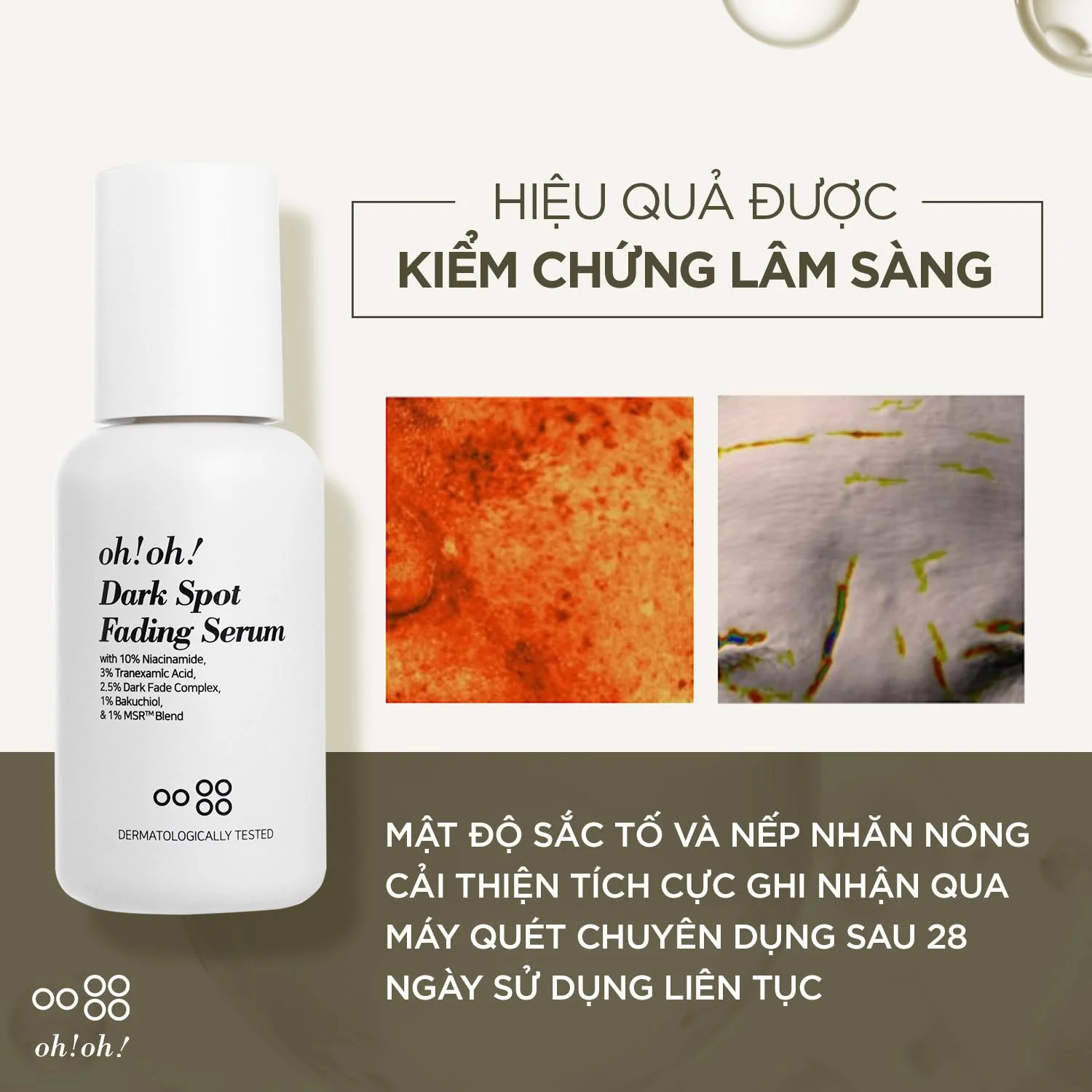Tinh chất oh!oh! Dark Spot Fading Serum 30ml - Giảm thâm nám và ngăn lão hóa