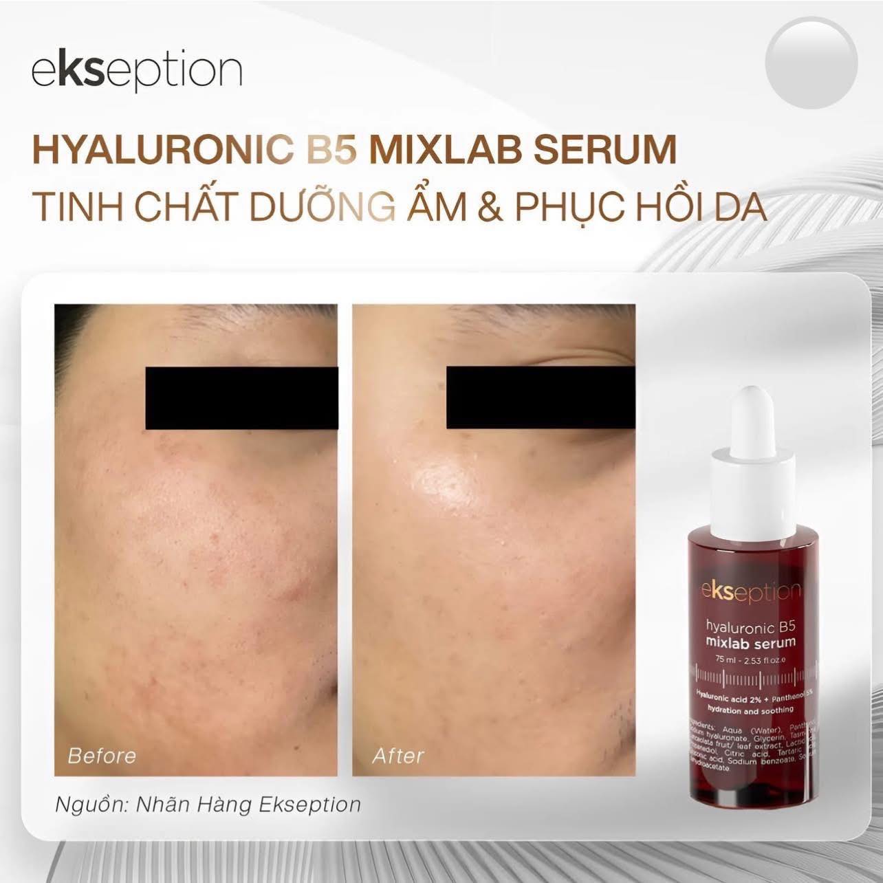 Tinh Chất Ekseption Hyaluronic B5 75ml -  Phục Hồi & Làm Dịu Da