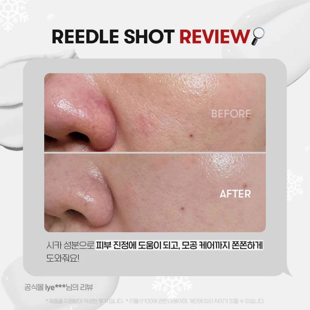 [HỒNG] #300 VT REEDLE SHOT 300